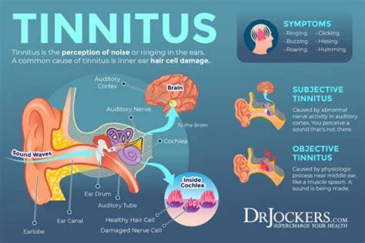 Can a virus cause tinnitus?