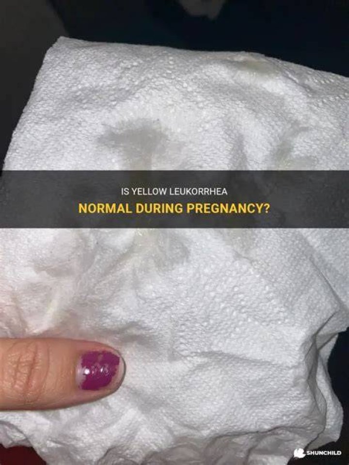 Can Leukorrhea be yellow?