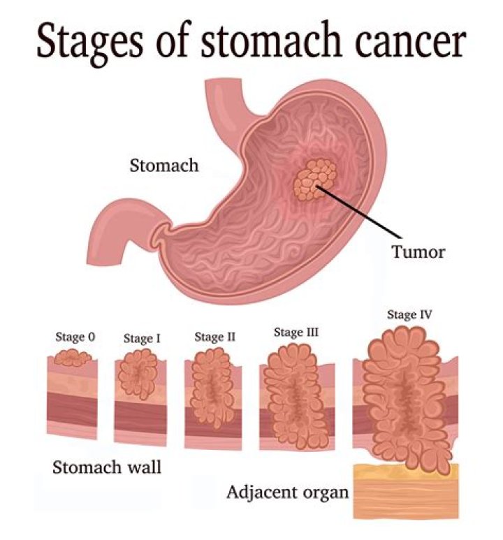 How long does stomach bug live on surfaces?