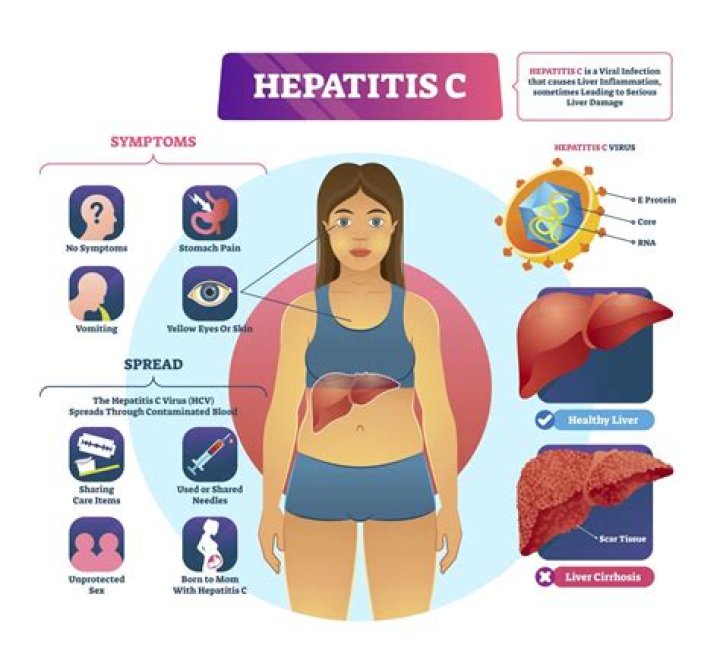 Is Hep C hard to catch?