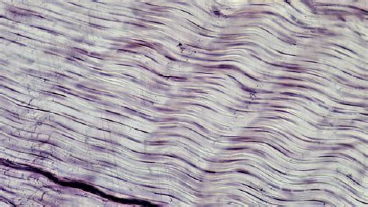 What are white fibrous tissue?