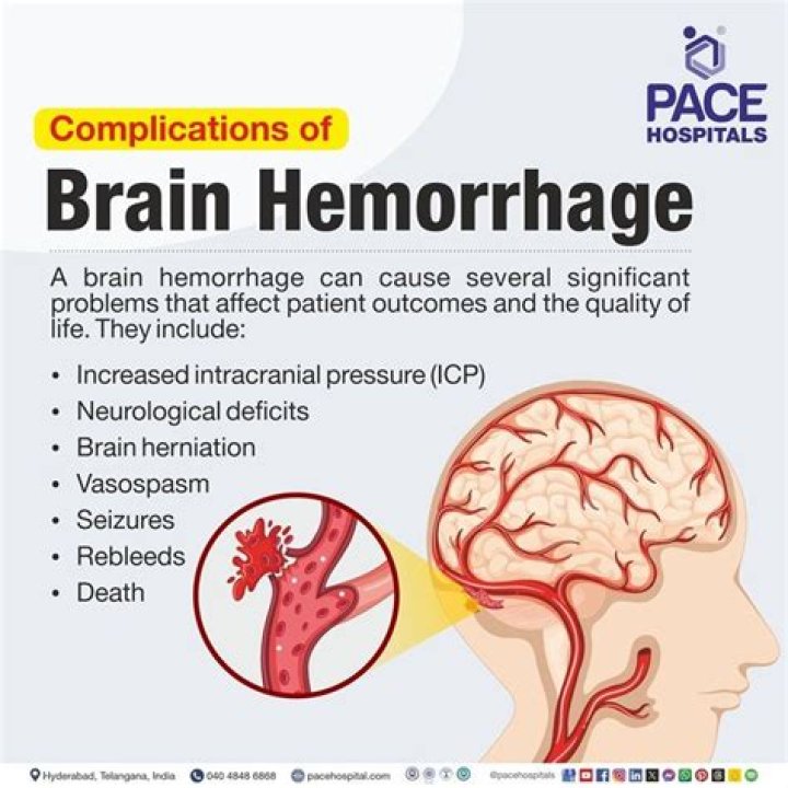 What causes Perigestational hemorrhage? | ContextResponse.com