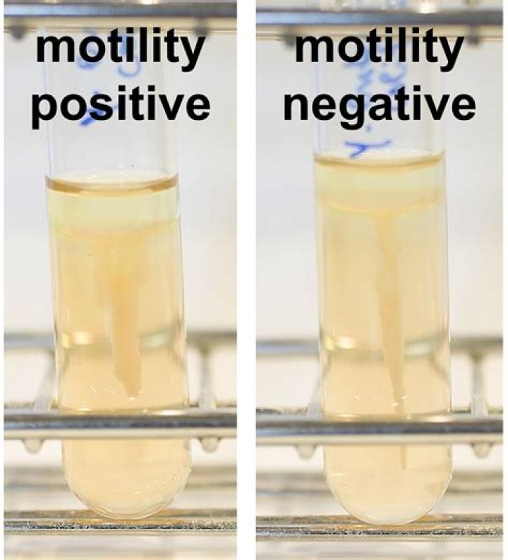 What could probably make motility test false negative?