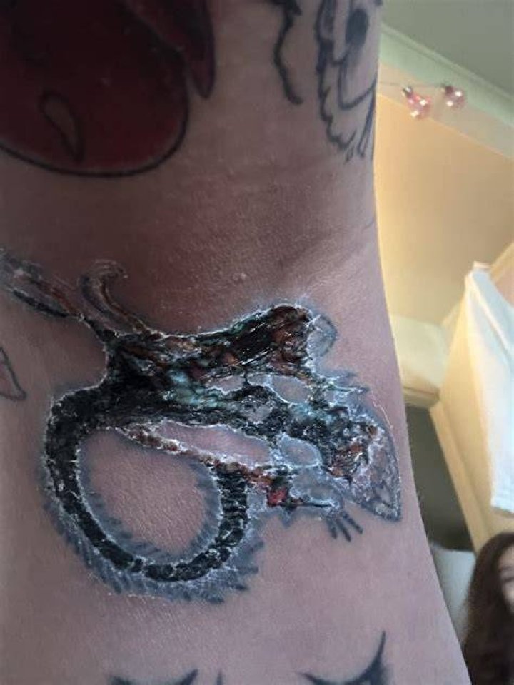 What is a ditch tattoo?