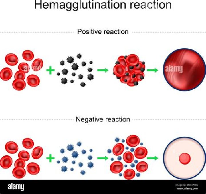 When agglutination occurs there is a match?