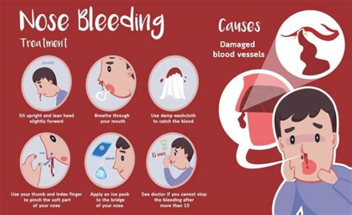 Why do I keep blowing my nose?