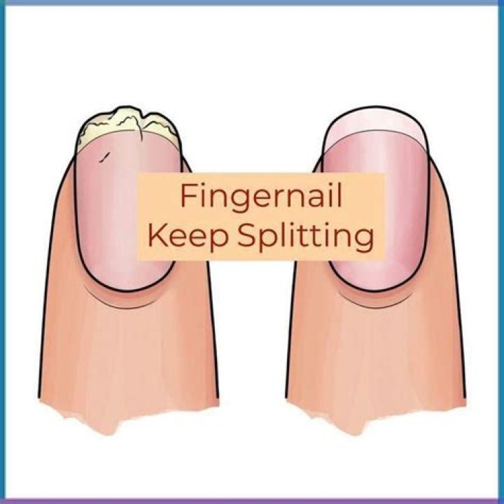 Why do my fingernails dip in the middle?